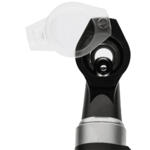 otoscope Smartlight examen oreille